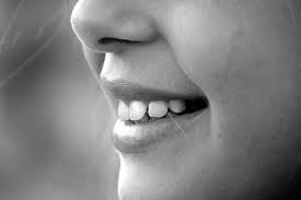 smile makeover